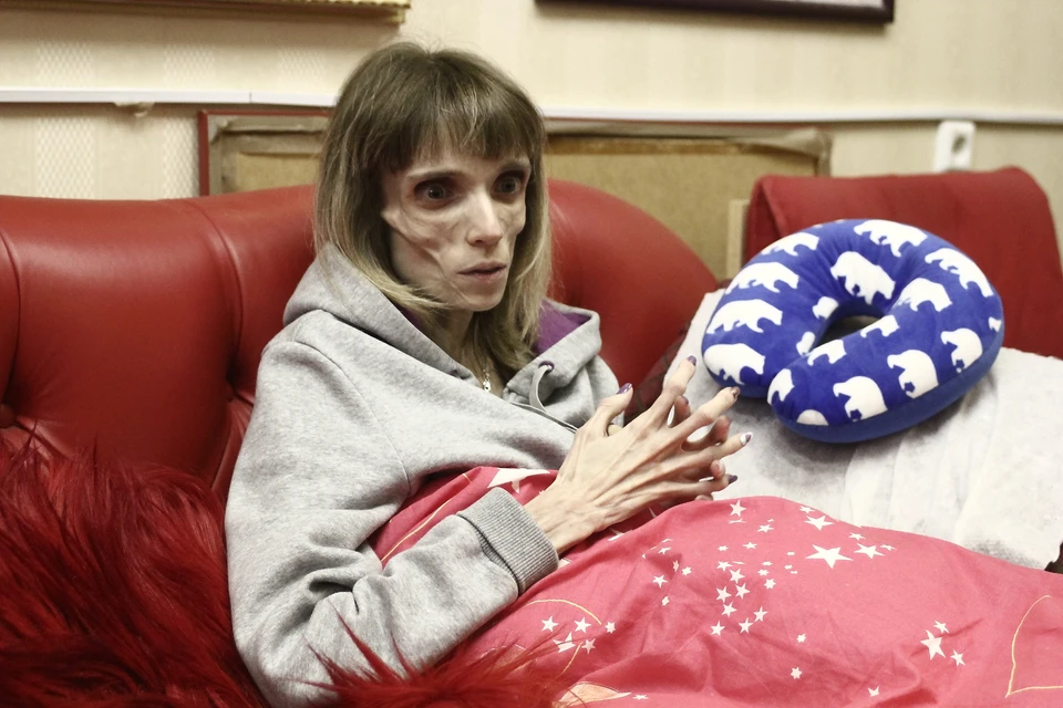 17-килограммовая Кристина Корягина начала набирать вес после лечения в Нижнем Новгороде