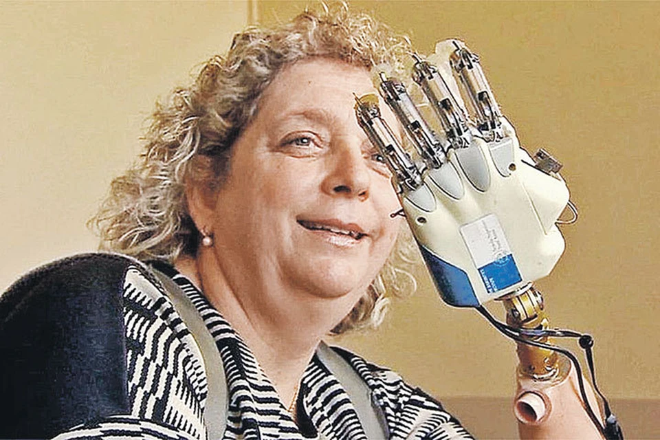 Свою руку Алмерина потеряла на производстве еще в 1993 году. Ждать новую женщине пришлось 25 лет… Фото: bbc.com