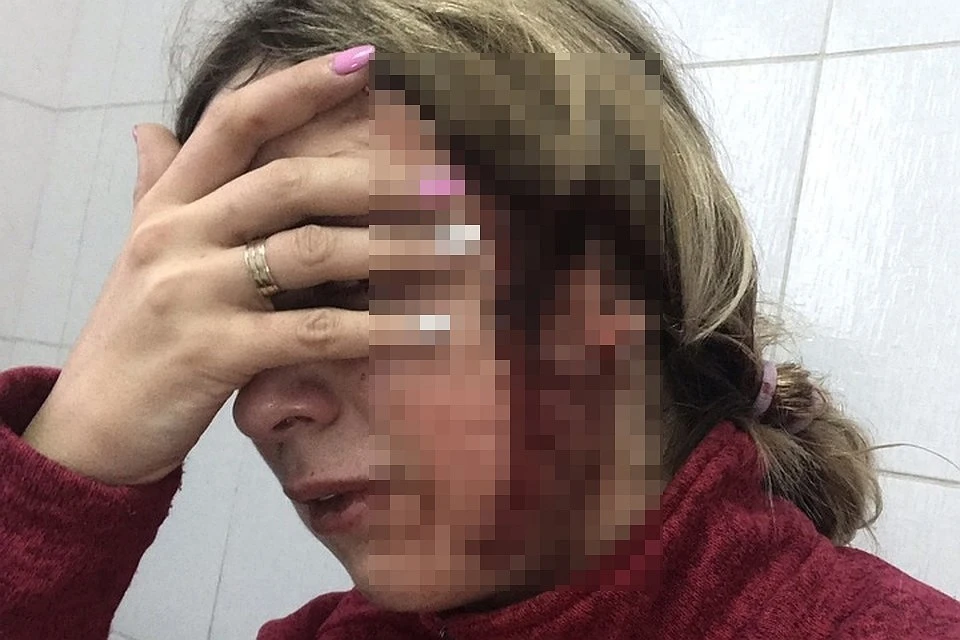 Удары автомобильной щеткой были настолько сильные, что врачи наложили Юлии Петуховой несколько швов.