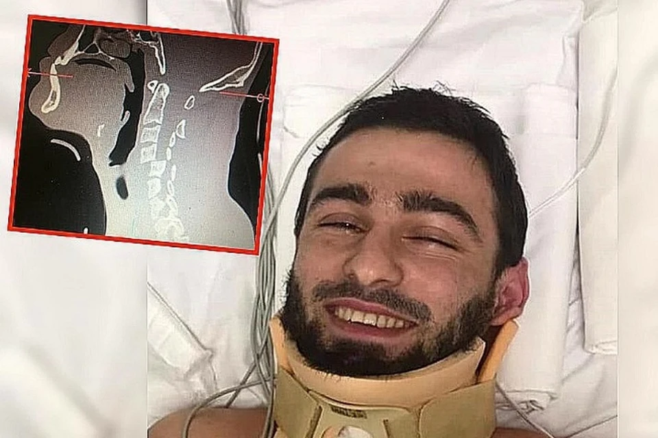Алиев еще в реанимации