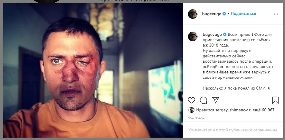 По словам актера, это фото для привлечения внимания. Оно со съемок 2018 года.