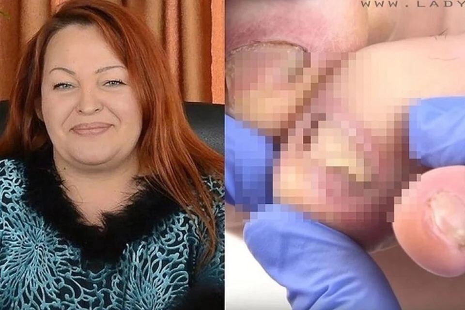 50-летняя женщина вела странички в социальных сетях, где выкладывала свои работы и подробно рассказывала о тяжелых случаях с ногтями. Фото: Скриншот канала Е. Дзык
