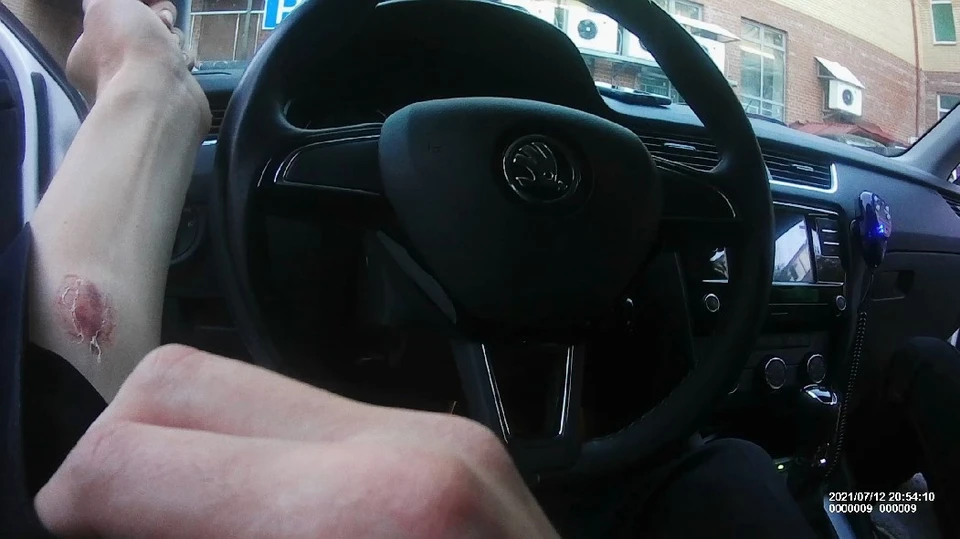 Тюменка до крови укусила автоинспектора при задержании.