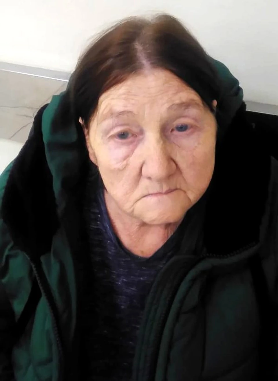 Потерять память может каждый...