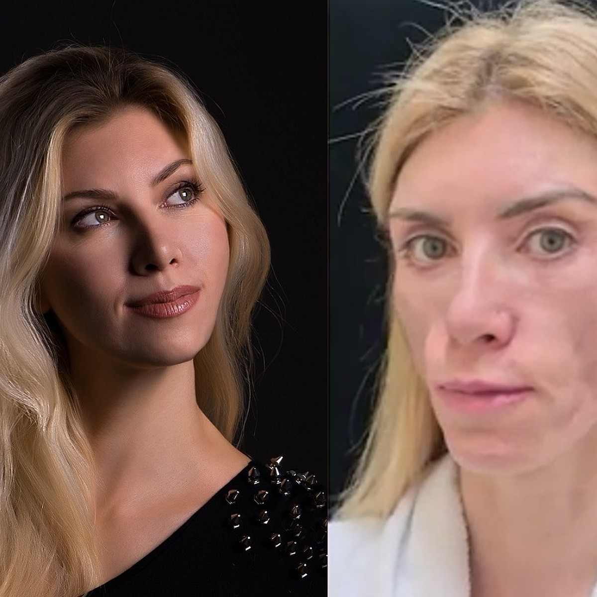 Supermaryface Plastic Surgery