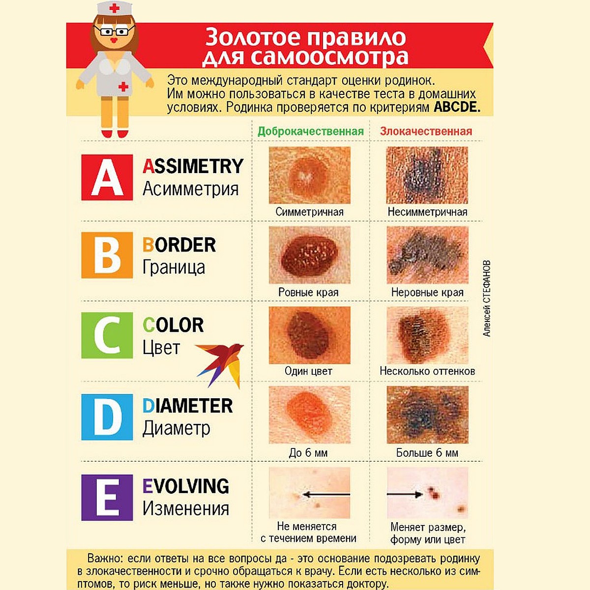 Опасная меланома - KP.RU