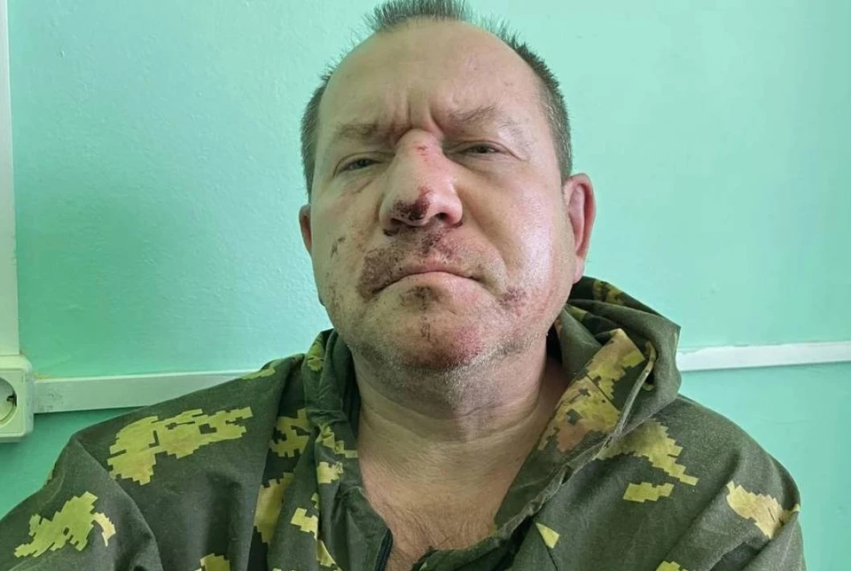 У пострадавшего сломаны нос и ребро ФОТО: Сергей Бабинец