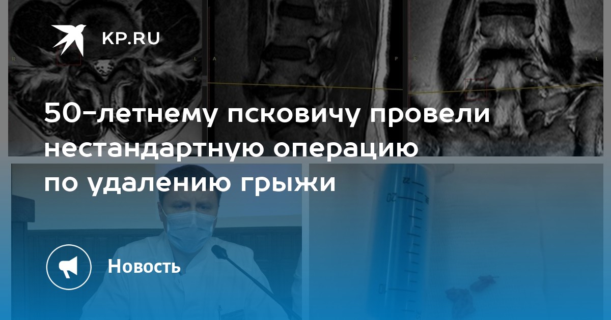 Аппарат ленивина для грыжи шейного отдела позвоночника. Операции по удалению грыжи шеи. Операция на шейном отделе позвоночника. Операции по удалению грыжи шеи. Операция на шейном отделе позвоночника грыжа.