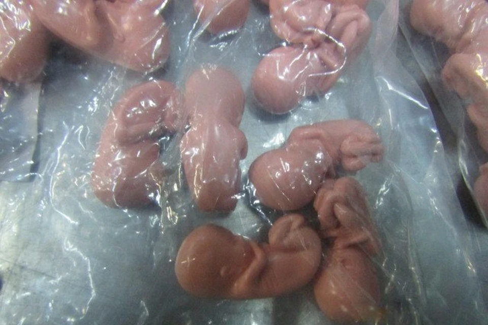 Модельки человеческих эмбрионов нашли в чемодане у туристки на границе Ленобласти и Эстонии. Фото: СЗТУ