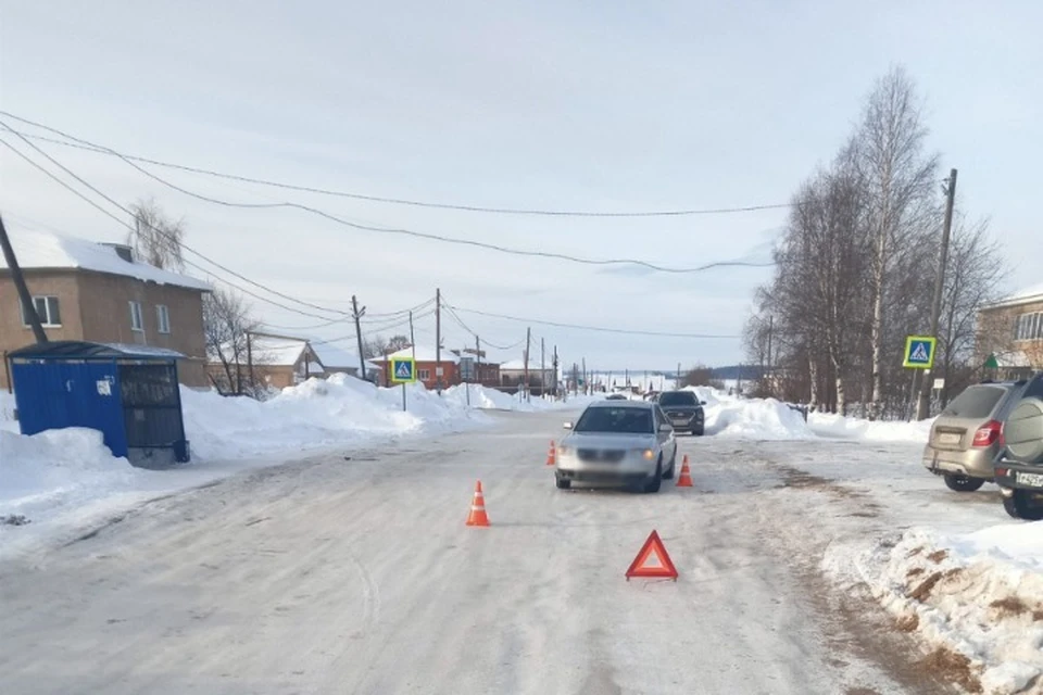 16-летняя девушка получила травмы в ДТП в Подшивалово. Фото: Госавтоинспекция Удмуртии