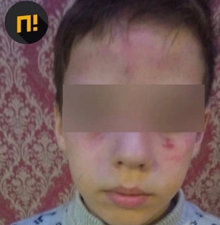 В Калужской области двое мужчин избили 9-летнего ребенка из-за собаки