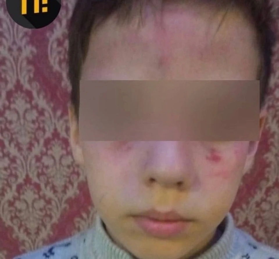 Пострадавший 9-летний мальчик