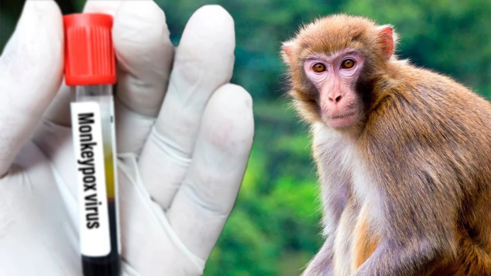 Выявлено более 240 случаев заражения новым, более смертоносным штаммом оспы обезьян. Фото:rupor.md