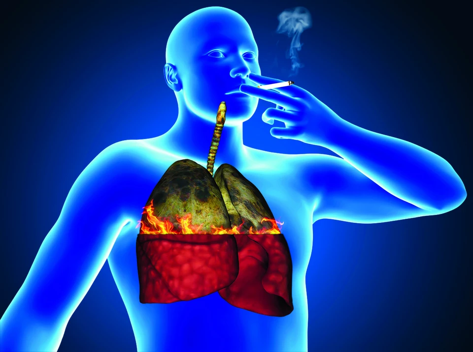 Риски возникновения онкологических заболеваний при курении