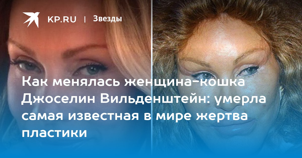 Как менялась женщина-кошка Джоселин Вильденштейн: умерла самая известная в мире жертва пластики