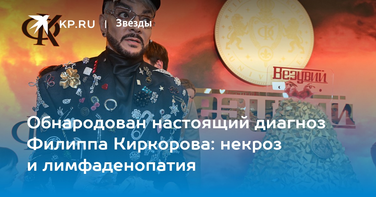 Шок в мире шоу-бизнеса: У Филиппа Киркорова диагностировали серьезные проблемы со здоровьем – некроз и лимфаденопатию