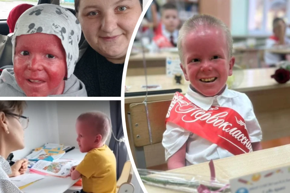 Мальчик за год встал на ноги и пошел в школу. Фото: Предоставлено семьей Переходченко, телеграм-канал «Семья для Никиты»