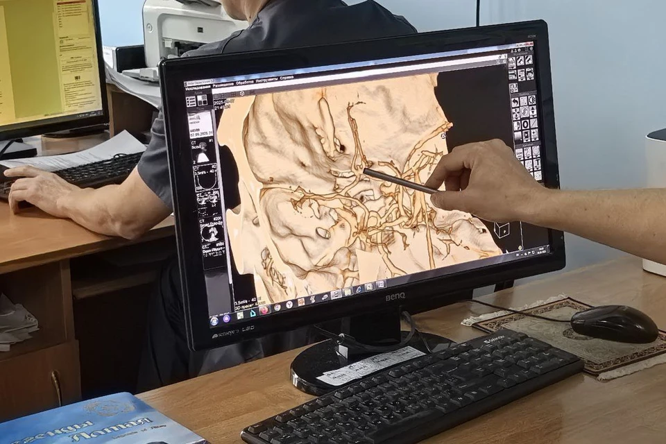 Аневризма - вырост на сосуде в виде мешочка, который имеет тонкую, неполноценную стенку