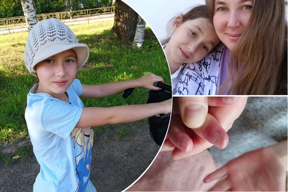 У девочки постоянно лопается кожа на руках и ногах. Фото: предоставлено КП-Новосибирск