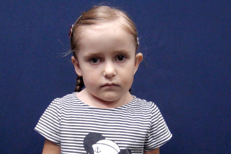 Владлена Драгоман, 6 лет, г. Кишинев. Диагноз: Врожденная аномалия развития шейных и верхне-грудных позвонков.