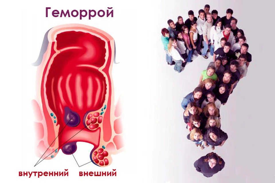 Кому нужен этот геморрой?