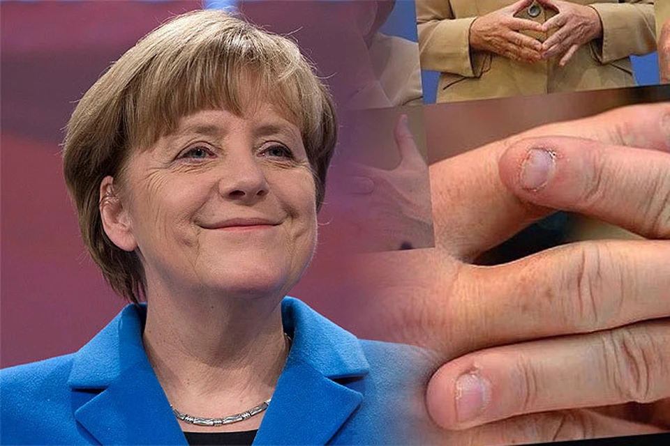 В интернете обсуждают неудачный маникюр канцлера Германии