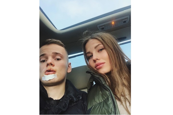За рулем в момент аварии находилась девушка Арсения Лиана. Ей повезло меньше - у нее сломано предплечье. Фото: Instagram